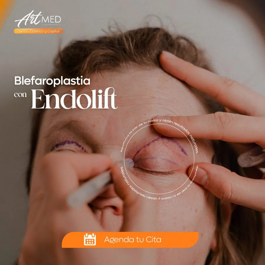 ArtMED — Blefaroplastia